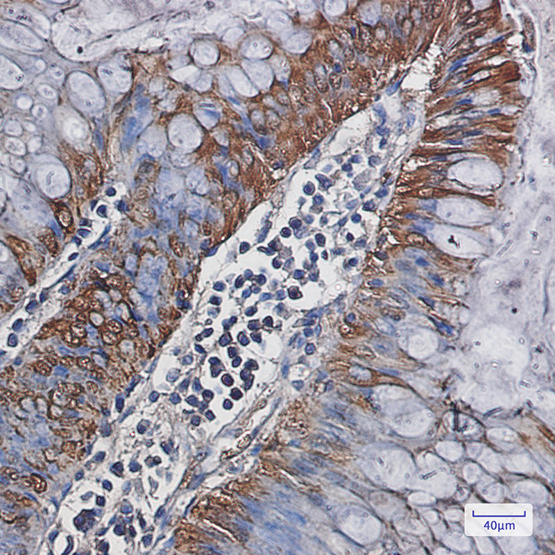2 - Carbonic Anhydrase 1 Rabbit mAb AP75187