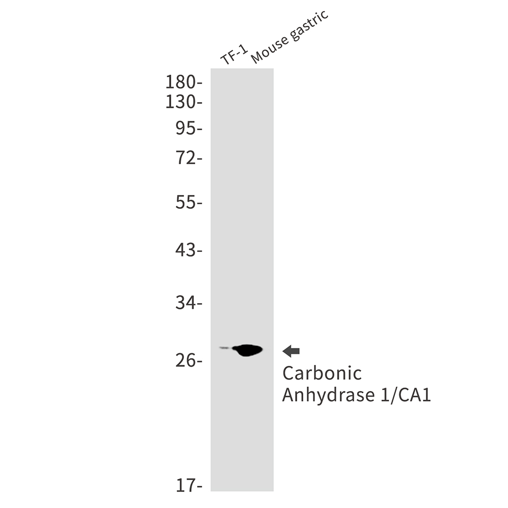 1 - Carbonic Anhydrase 1 Rabbit mAb AP75187