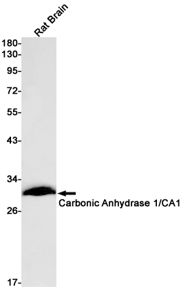 4 - Carbonic Anhydrase 1 Rabbit mAb AP75187