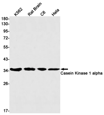 1 - [KD]Casein Kinase 1 alpha Rabbit mAb AP75189