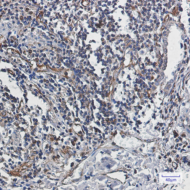 2 - Caspase-10/CASP-10 Rabbit mAb AP75192