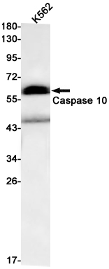 1 - Caspase-10/CASP-10 Rabbit mAb AP75192