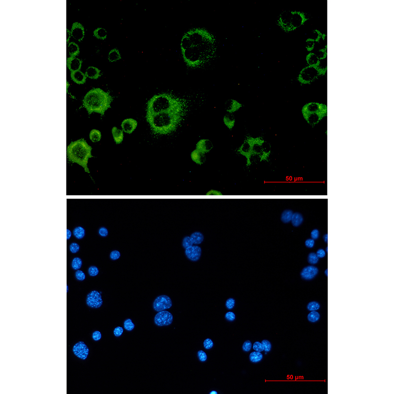 4 - [KO]Catalase Rabbit mAb AP75198