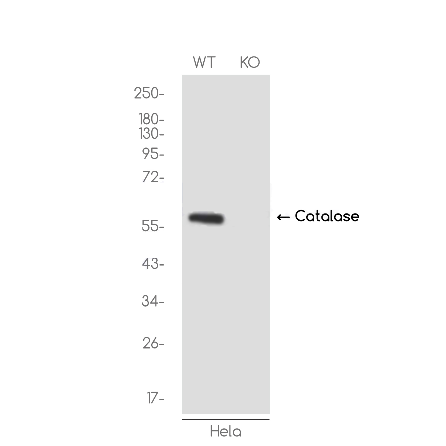 1 - [KO]Catalase Rabbit mAb AP75198