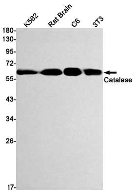 8 - [KO]Catalase Rabbit mAb AP75198