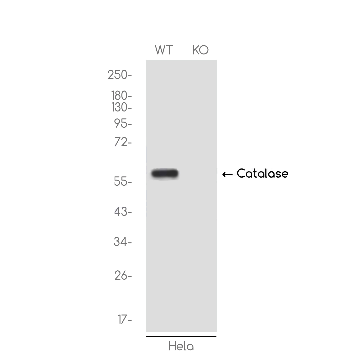1 - [KO]Catalase Rabbit mAb AP75199
