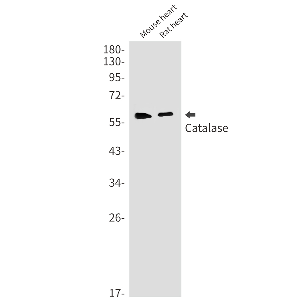 2 - [KO]Catalase Rabbit mAb AP75199