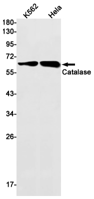 0 - [KO]Catalase Rabbit mAb AP75199