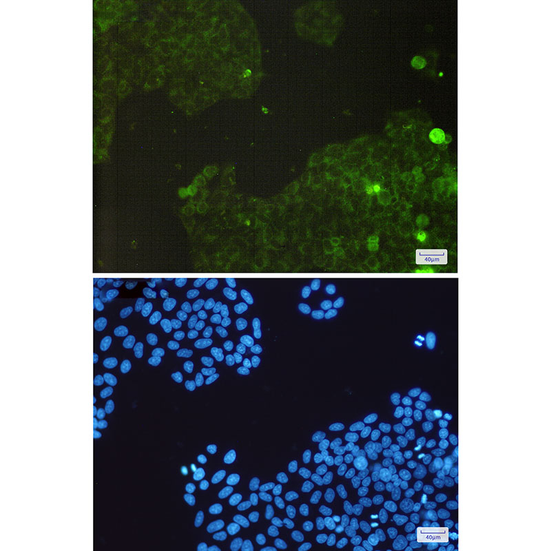 8 - [KO]Catalase Rabbit mAb AP75200