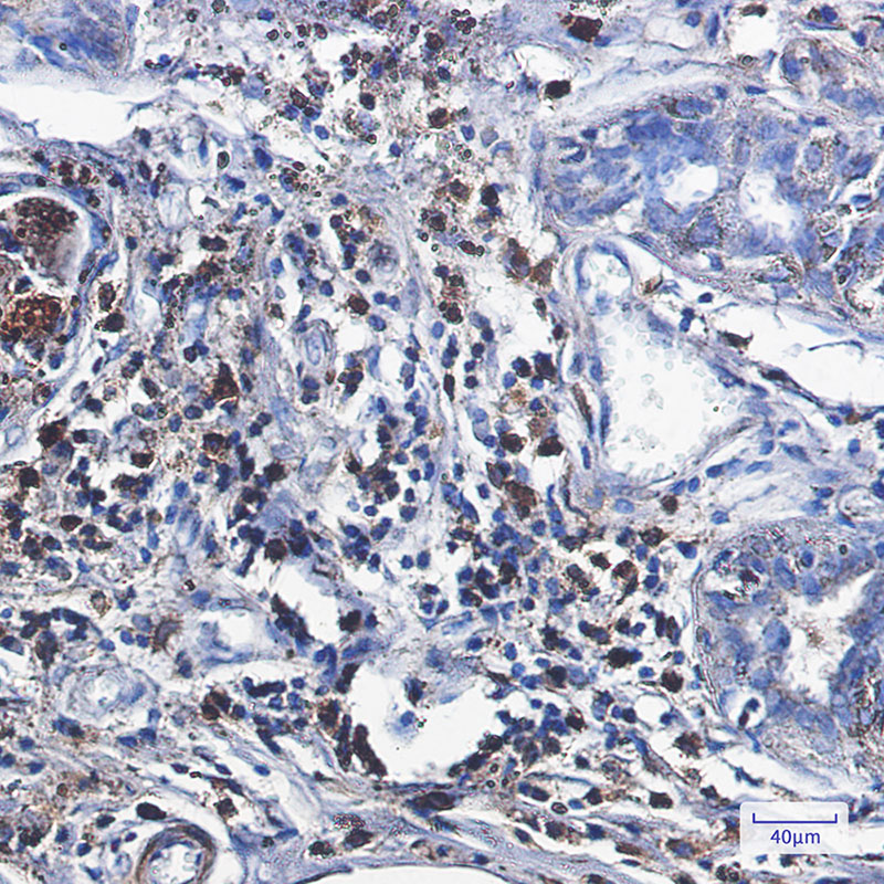 0 - [KO]Catalase Rabbit mAb AP75200
