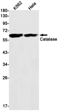 2 - [KO]Catalase Rabbit mAb AP75200