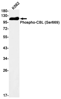1 - Phospho-CBL (Ser669) Rabbit mAb AP75205