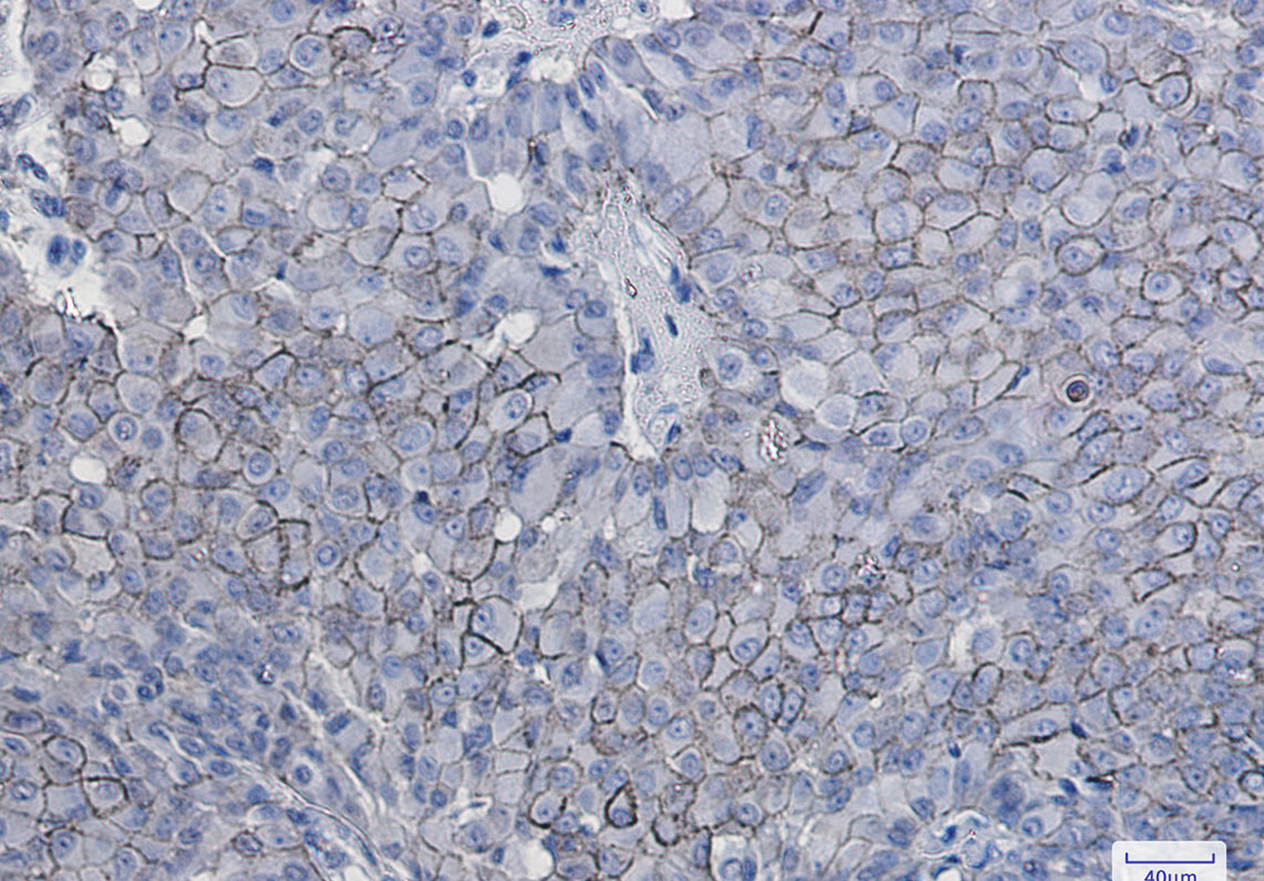 4 - CD166 Rabbit mAb AP75212