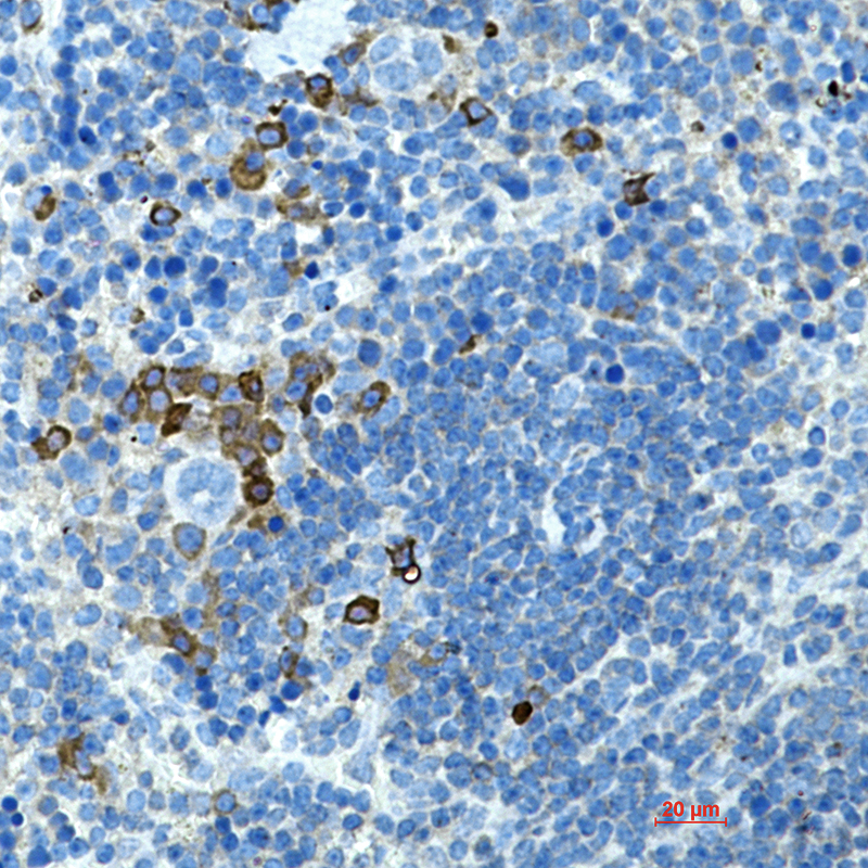 1 - CD272/BTLA Rabbit mAb AP75219