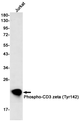 1 - Phospho-CD3 zeta (Tyr142) Rabbit mAb AP75223