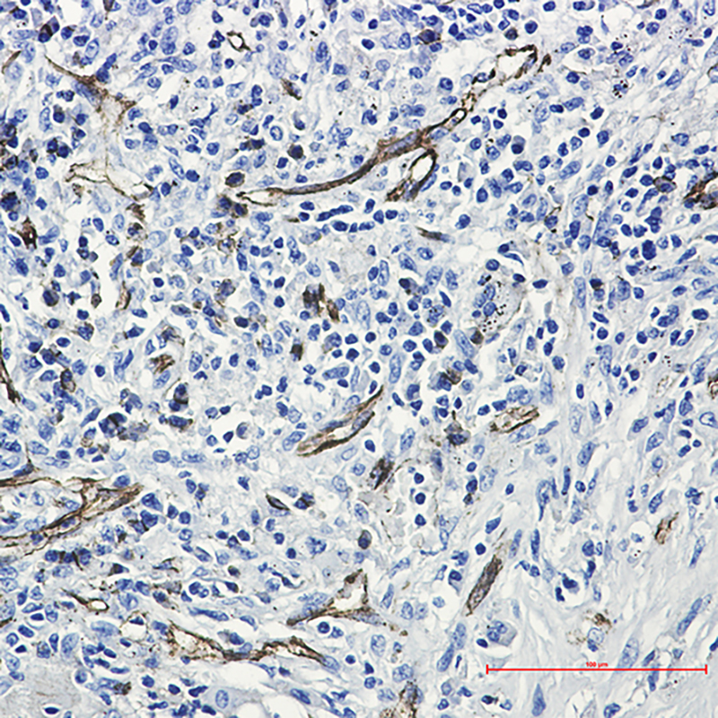 2 - CD31 Rabbit mAb AP75224