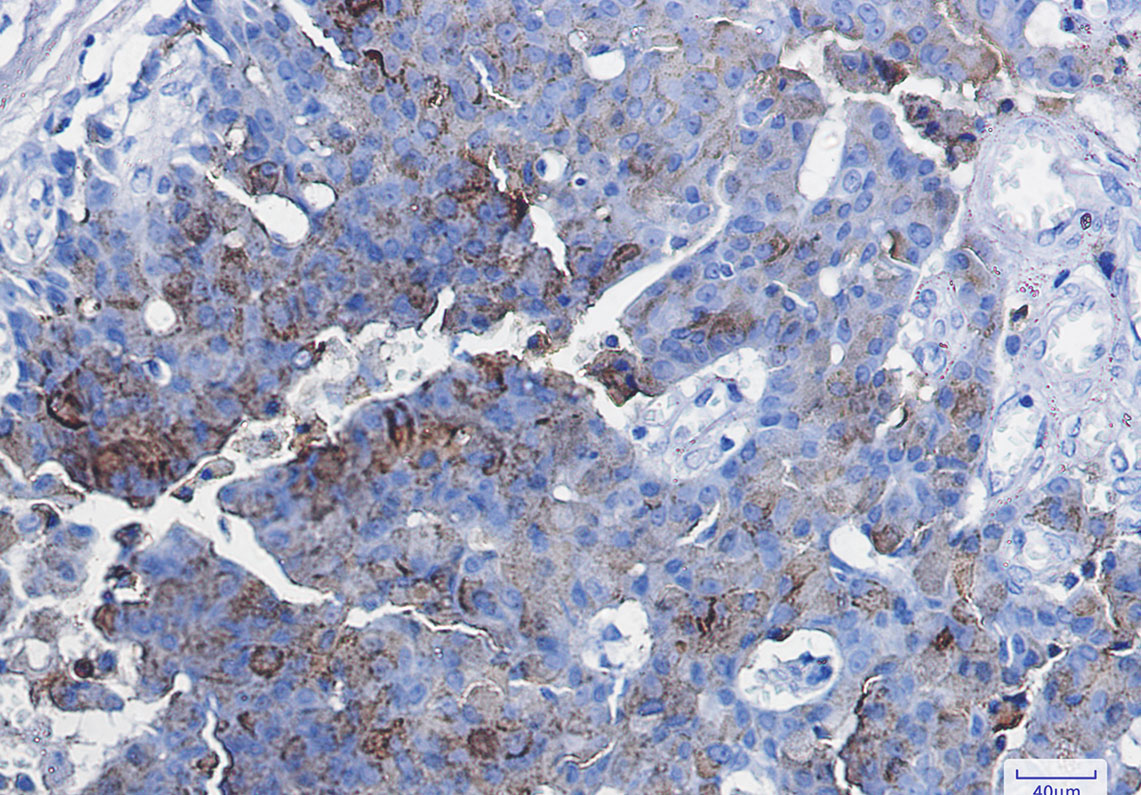2 - CD63 Rabbit mAb AP75233