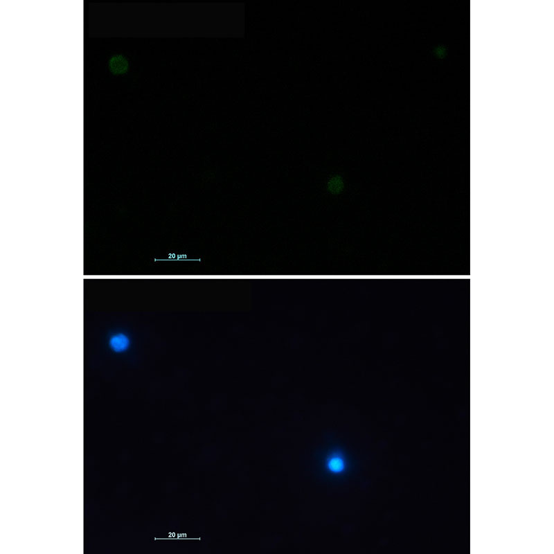 1 - CD79a Rabbit mAb AP75235