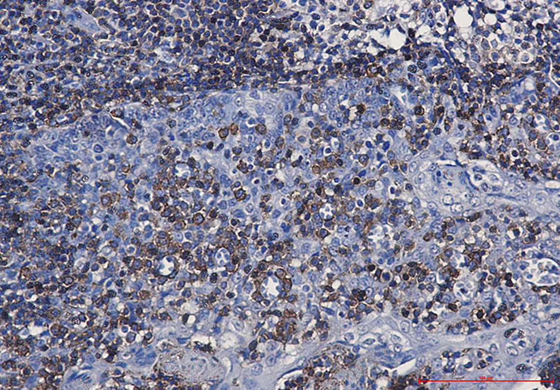 8 - CD79a Rabbit mAb AP75235