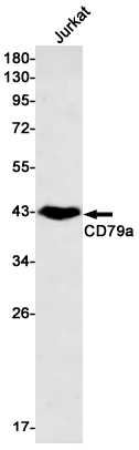 2 - CD79a Rabbit mAb AP75235