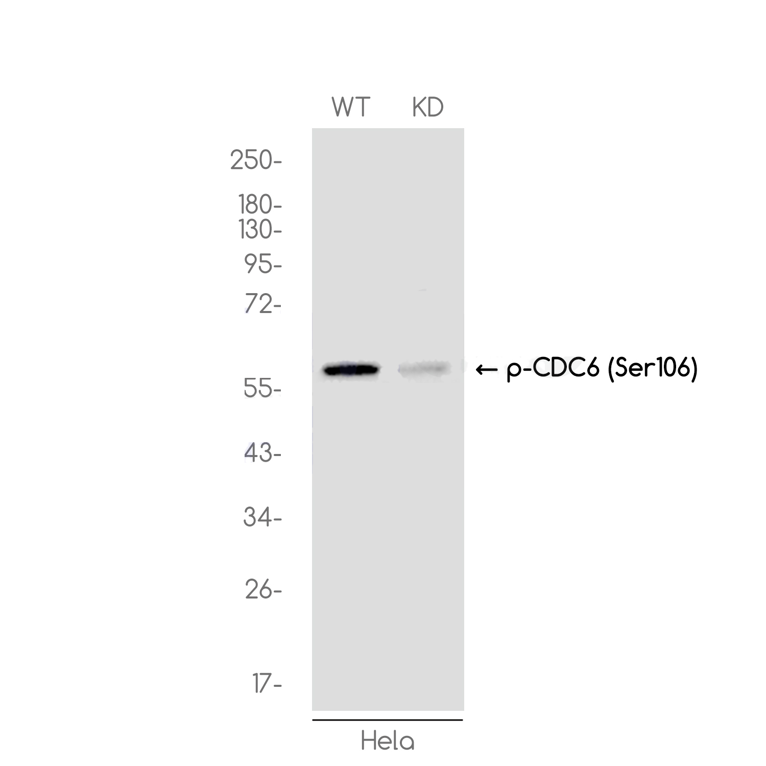1 - [KD]Phospho-CDC6 (Ser106) Rabbit mAb AP75240