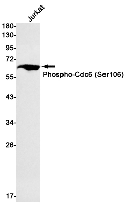 0 - [KD]Phospho-CDC6 (Ser106) Rabbit mAb AP75240