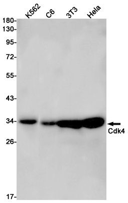 1 - CDK4 Rabbit mAb AP75245