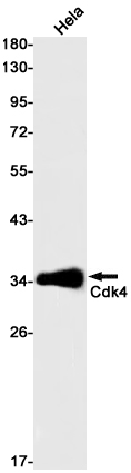 1 - CDK4 Rabbit mAb AP75246