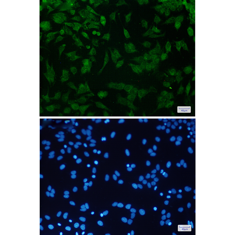 4 - CDKN2A/p16INK4a Rabbit mAb AP75248