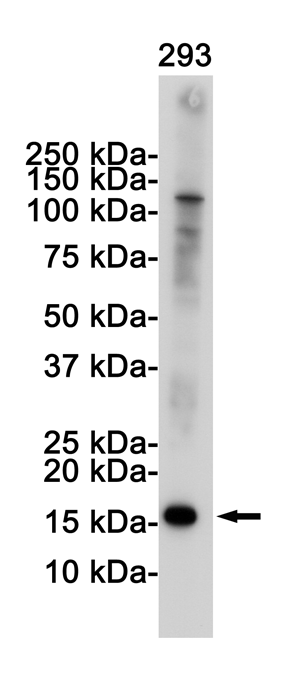 1 - CDKN2A/p16INK4a Rabbit mAb AP75248