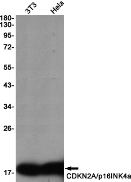 8 - CDKN2A/p16INK4a Rabbit mAb AP75248