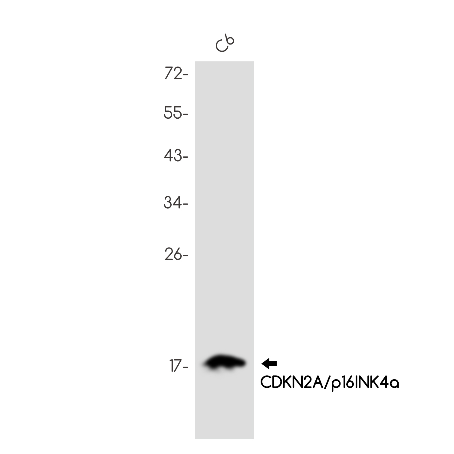 8 - CDKN2A/p16INK4a Rabbit mAb AP75249