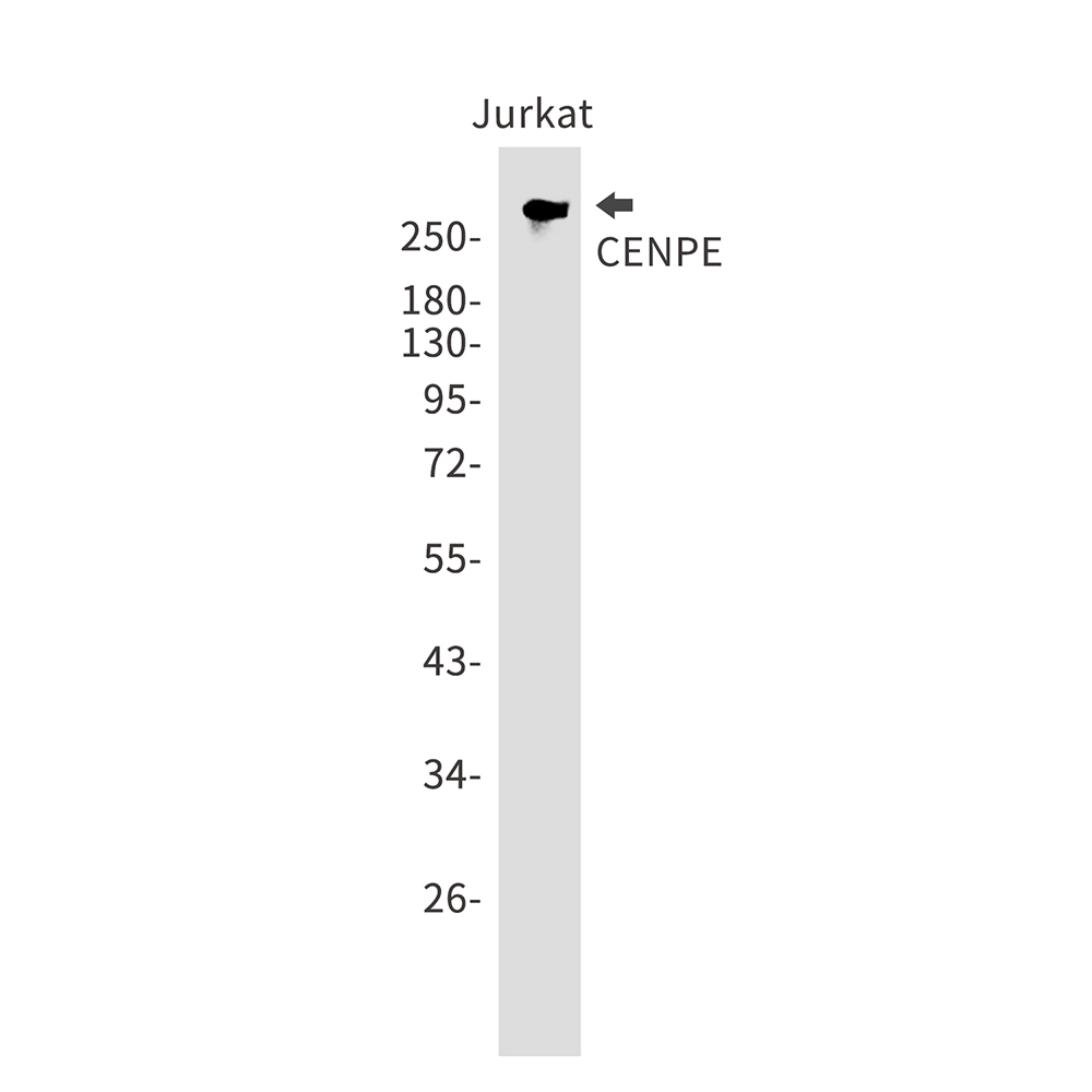 1 - CENPE Rabbit mAb AP75255
