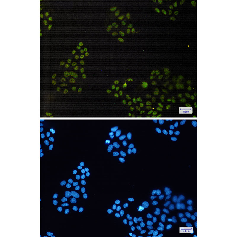 2 - [KD]CGBP Rabbit mAb AP75257