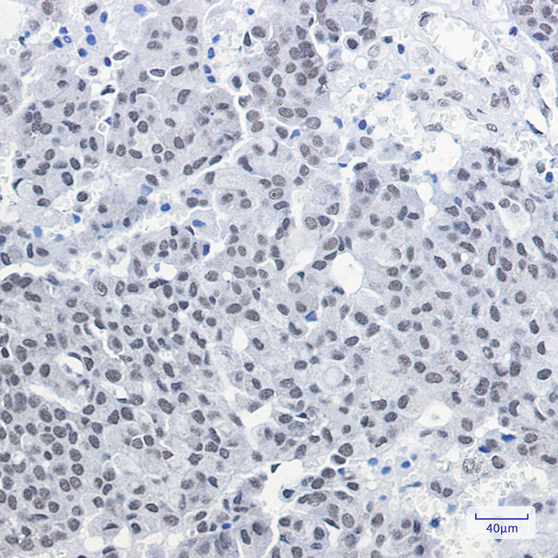 8 - [KD]CGBP Rabbit mAb AP75257