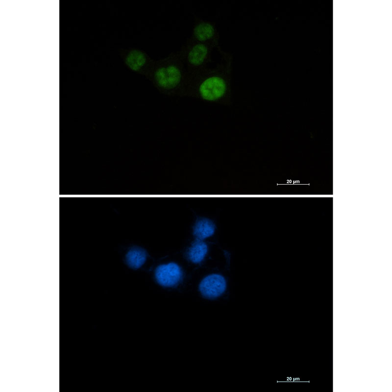 8 - [KO]Chk2 Rabbit mAb AP75259