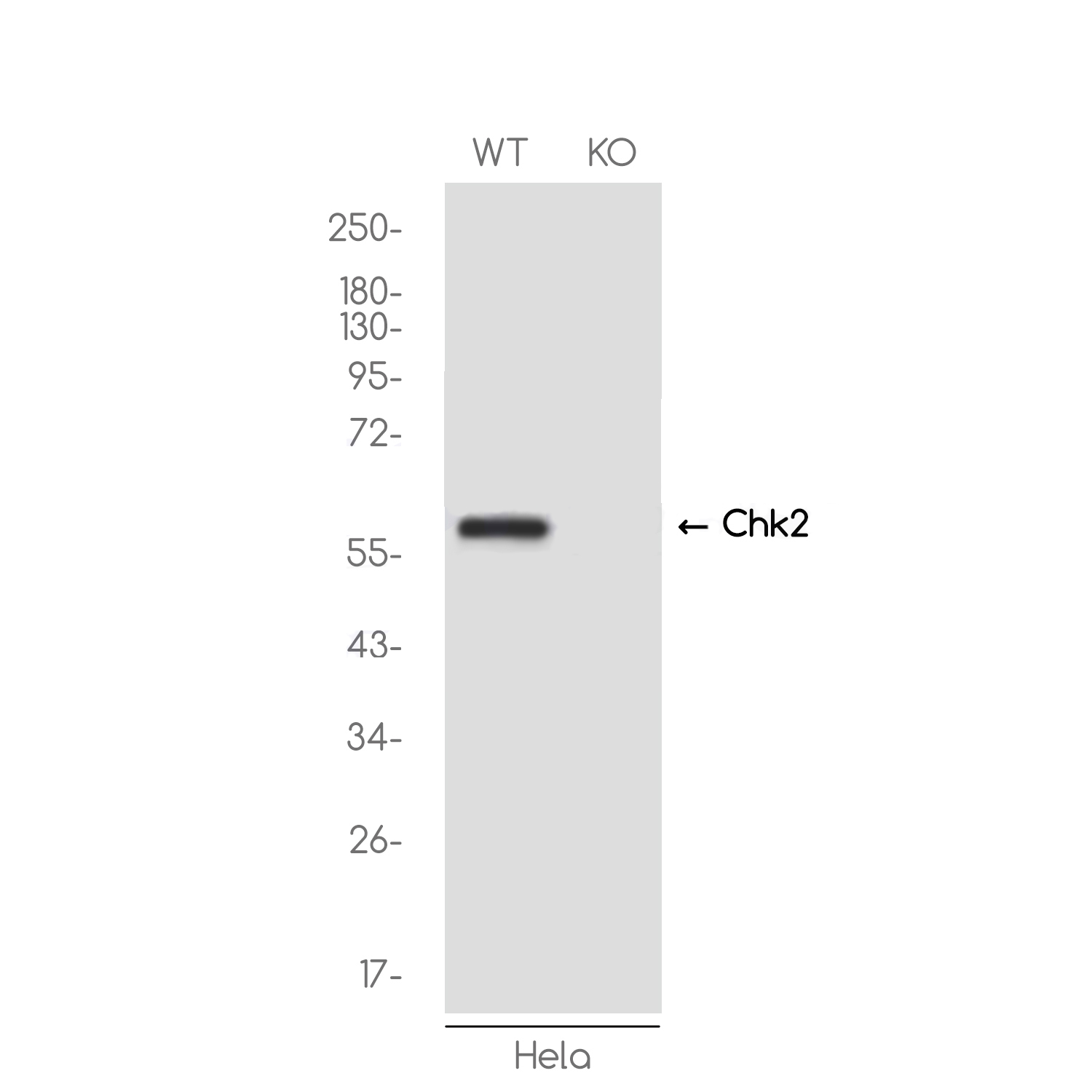 1 - [KO]Chk2 Rabbit mAb AP75259