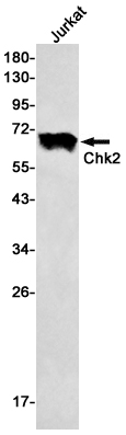 2 - Chk2 Rabbit mAb AP75260
