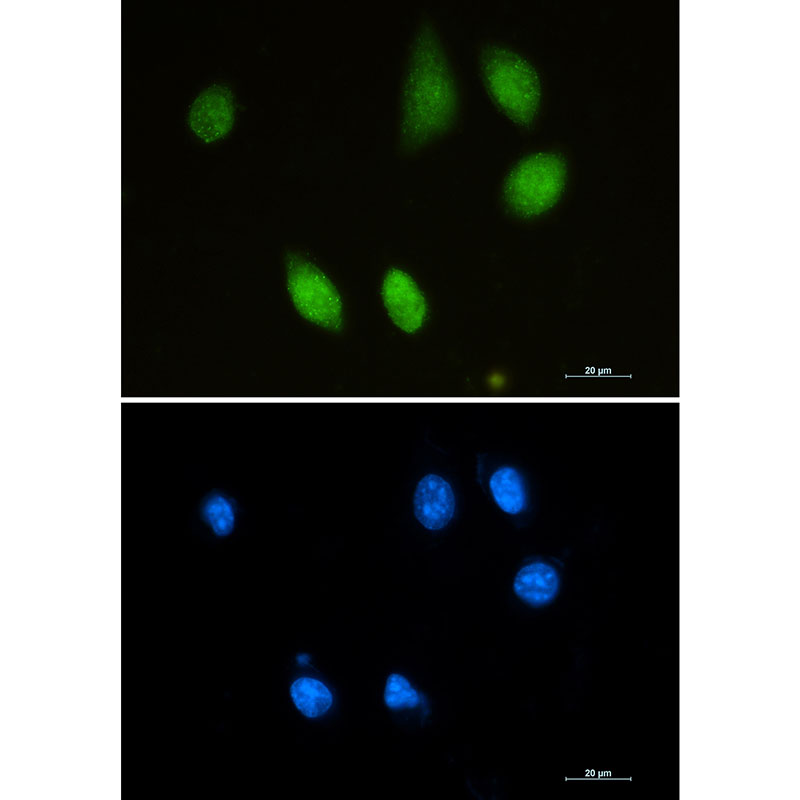 1 - Choline Acetyltransferase Rabbit mAb AP75261