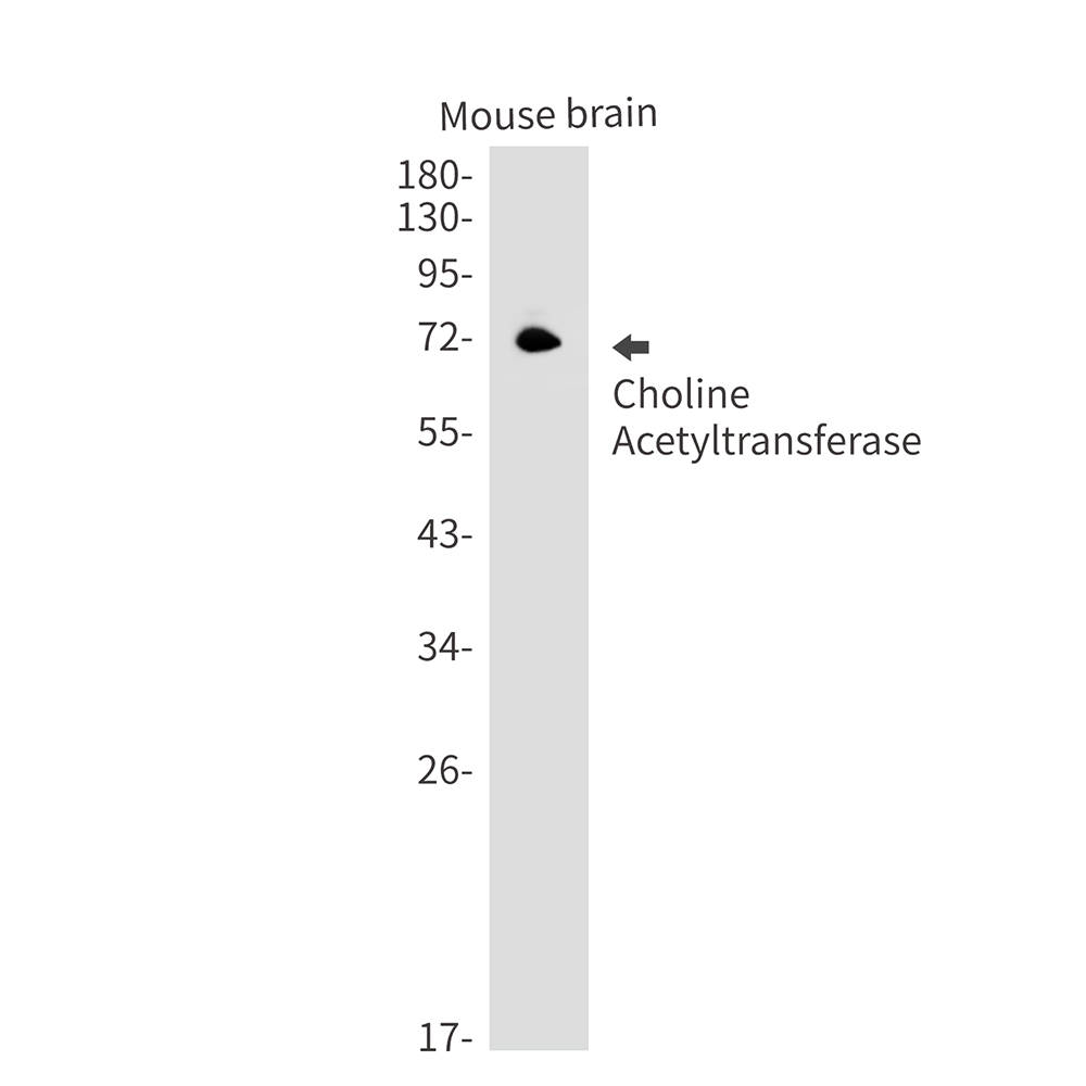 2 - Choline Acetyltransferase Rabbit mAb AP75261