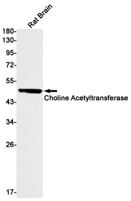 8 - Choline Acetyltransferase Rabbit mAb AP75261