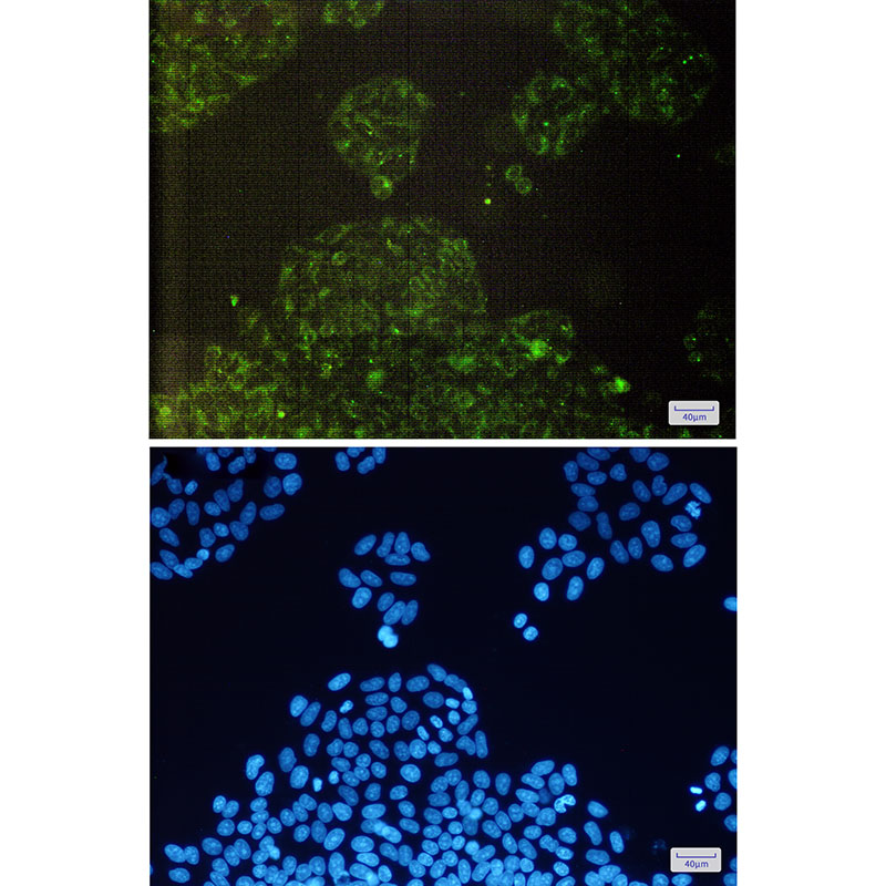 2 - cIAP1 Rabbit mAb AP75264