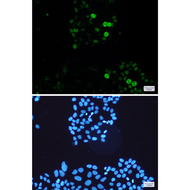 8 - Phospho-c-Myc (Ser62) Rabbit mAb AP75275