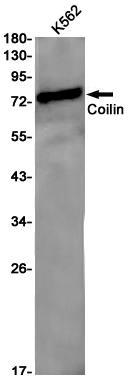 1 - Coilin Rabbit mAb AP75277