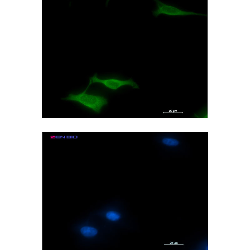1 - [KO]COX5B Rabbit mAb AP75285
