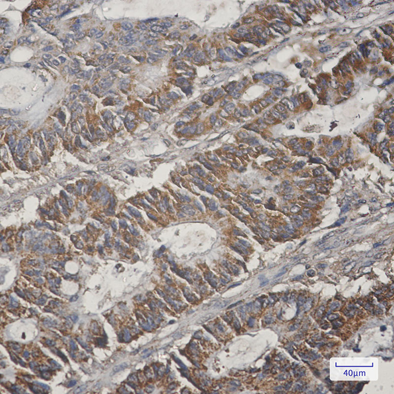 8 - [KO]COX5B Rabbit mAb AP75285