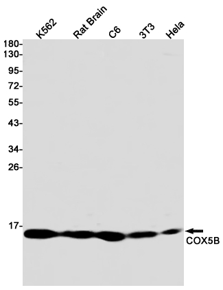 2 - [KO]COX5B Rabbit mAb AP75285