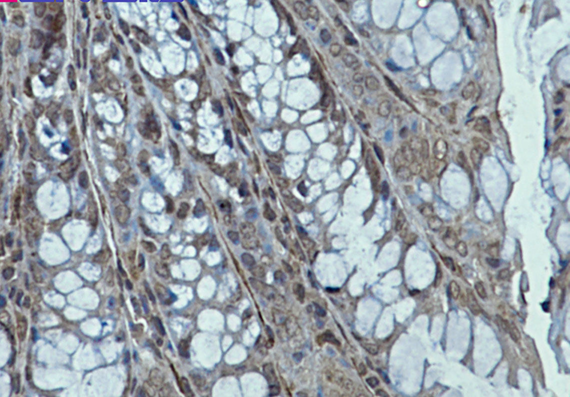 2 - [KD]Creatine Kinase B type Rabbit mAb AP75288
