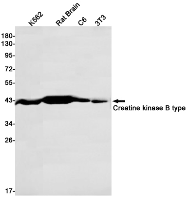 0 - [KD]Creatine Kinase B type Rabbit mAb AP75288