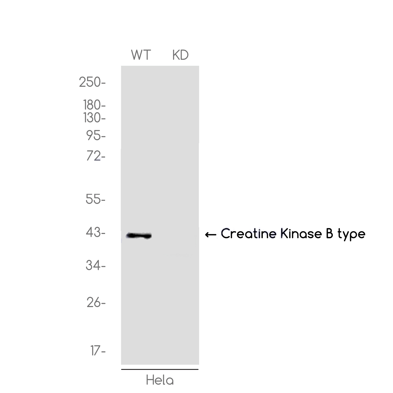 1 - [KD]Creatine Kinase B type Rabbit mAb AP75289